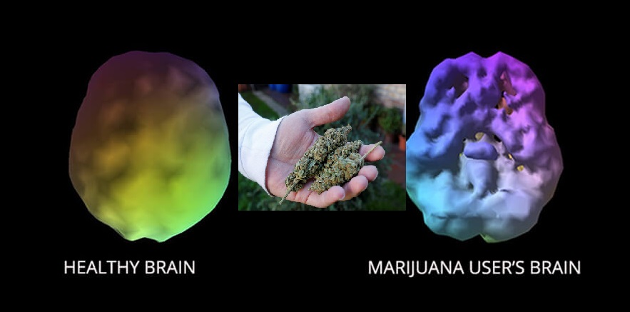 brain